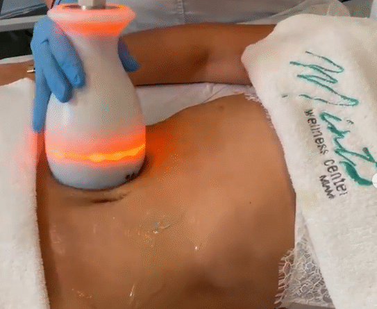 DualSculpt: el tratamiento corporal que redefine tu figura